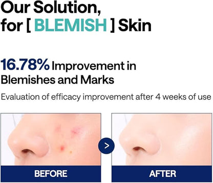 [MEDIHEAL] Madecassoside Blemish Pad 100pcs